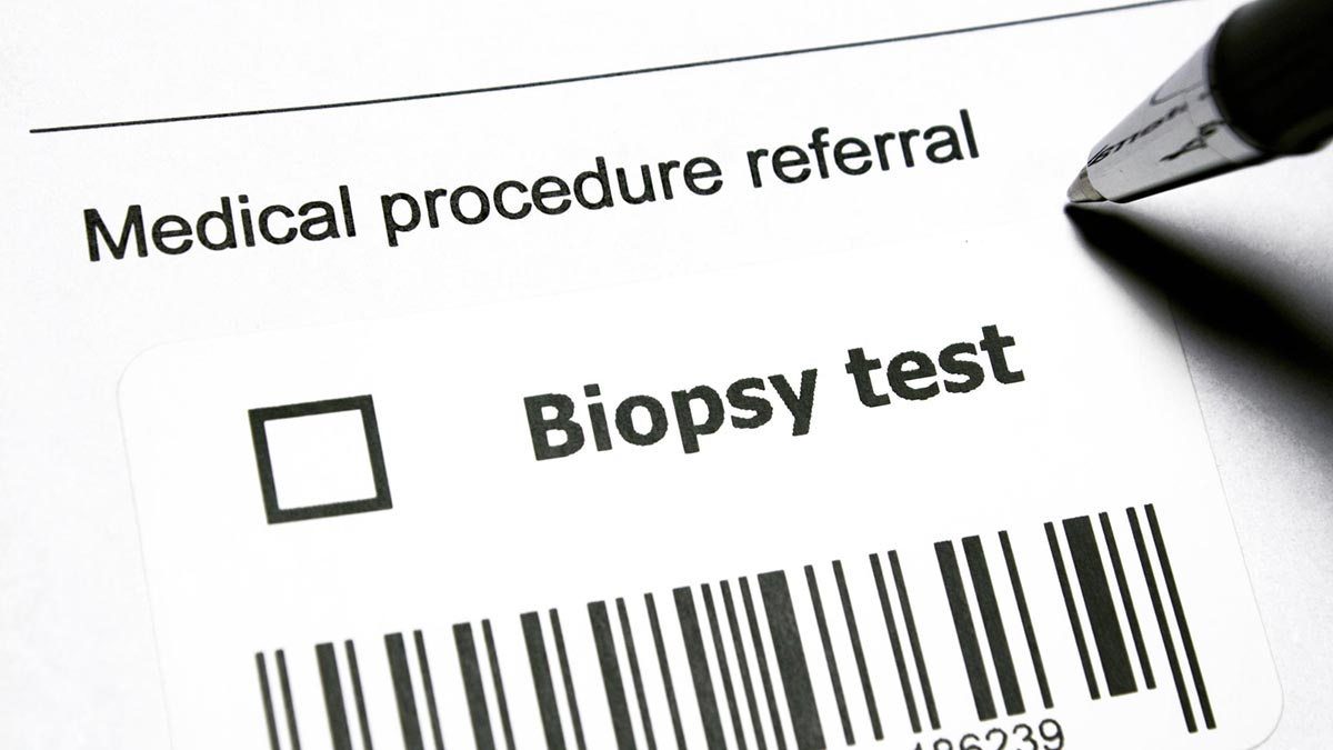 The Problem with Systematic Prostate Biopsy