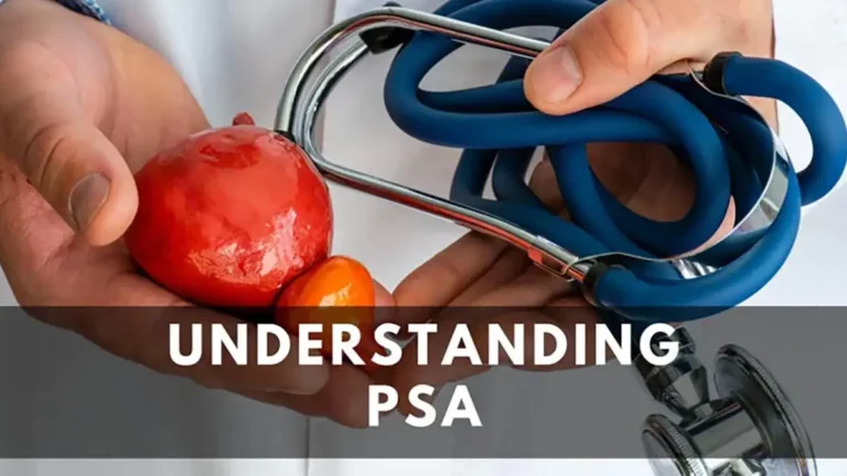 Understanding PSA Levels for Prostate Cancer, Doctor holding prostate model and stethoscope