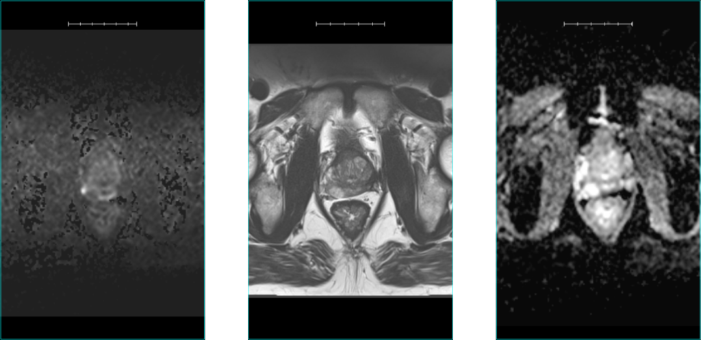 Diagnostic Mpmris Fla