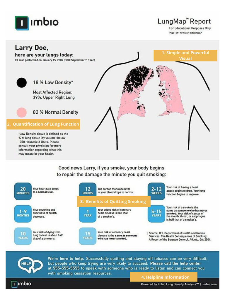 Imbio Patient Lung Map