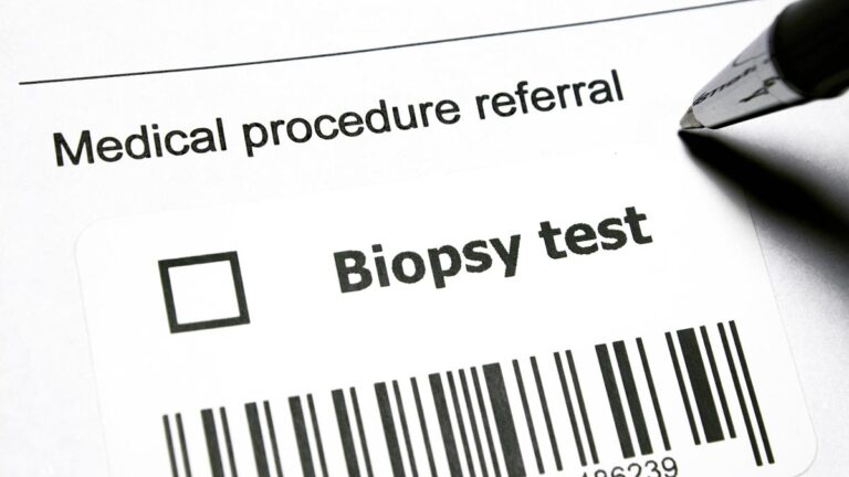 Biopsy Test Systematic Problem