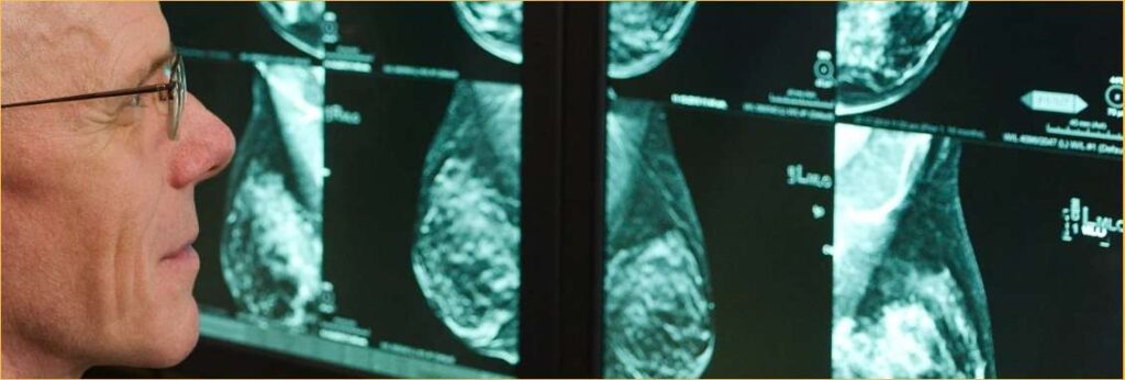 Doctor Reading Mammogram