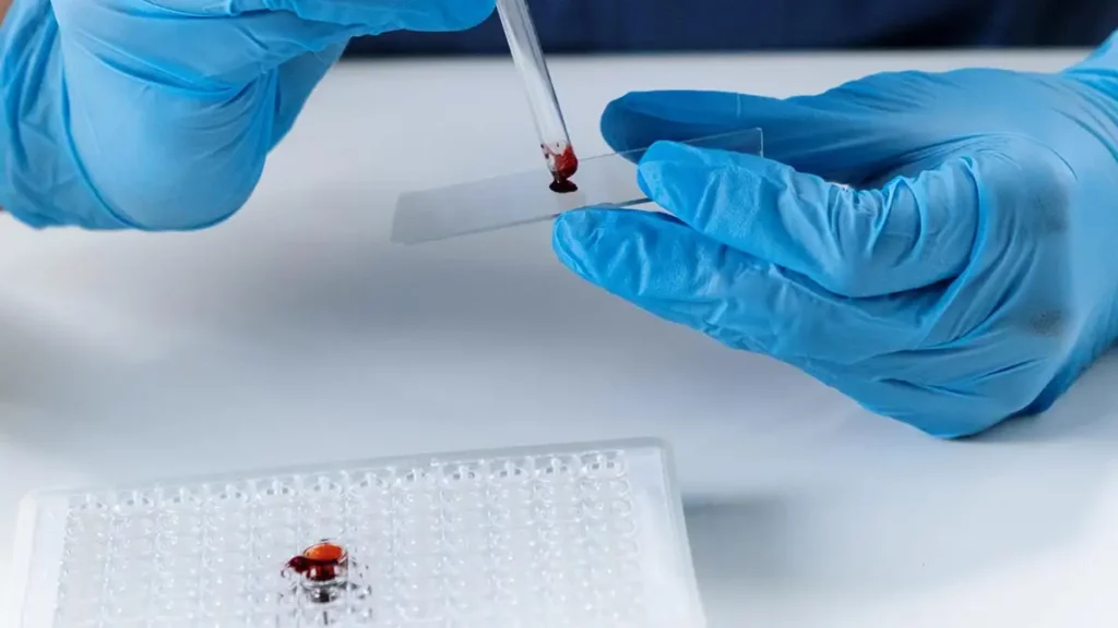 Genomic Testing Blood Sample