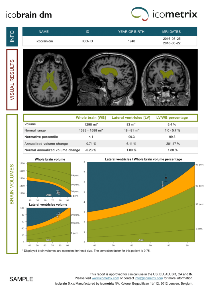 Icobrain Report 5 (1)