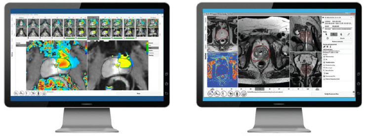 Tulsa Imaging on two monitors