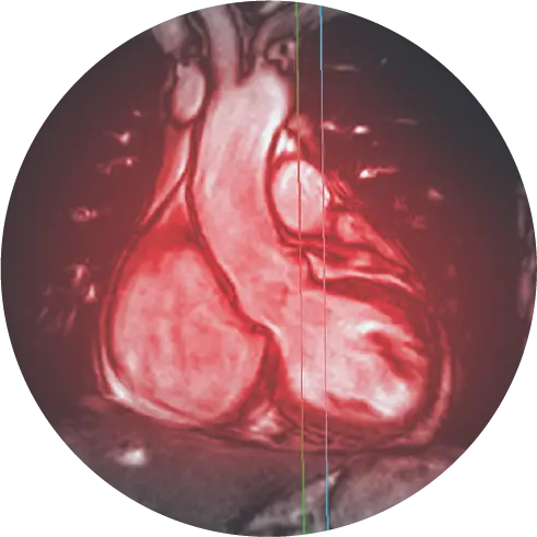 Cardiac Scan