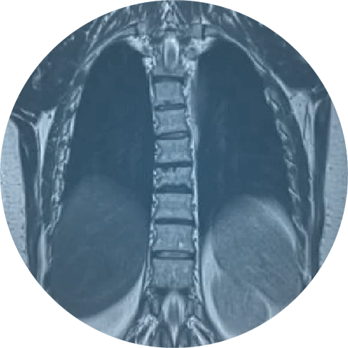 Lung Imaging