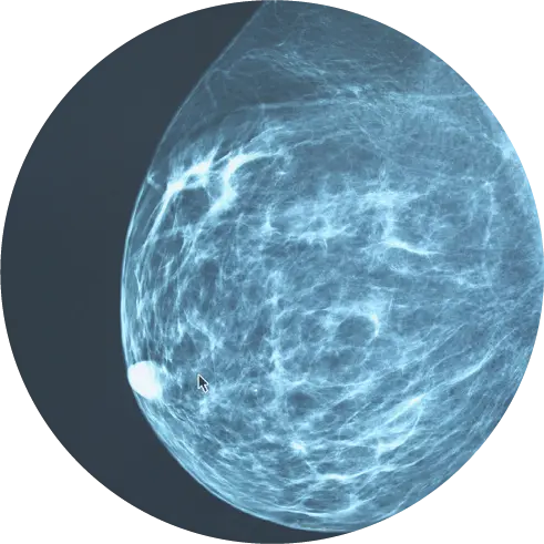 Mammogram Scan