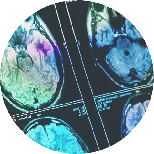 Neuro Scan