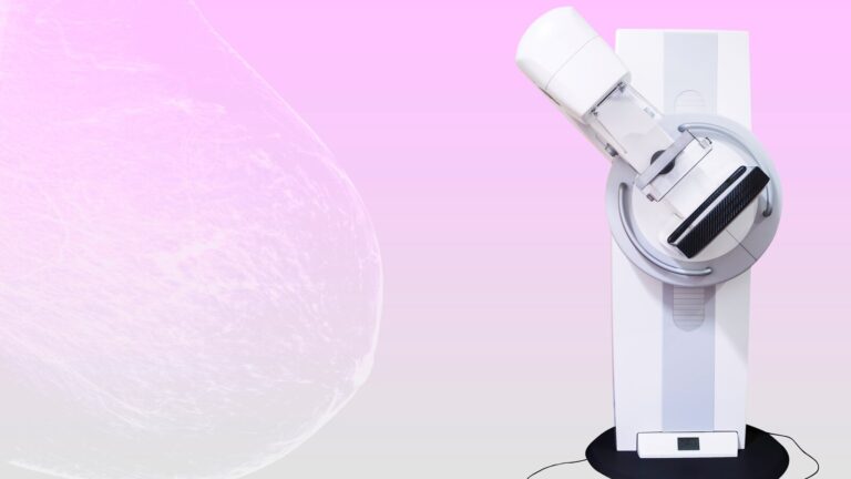 3D mammogram machine next to a scan of a woman's breast